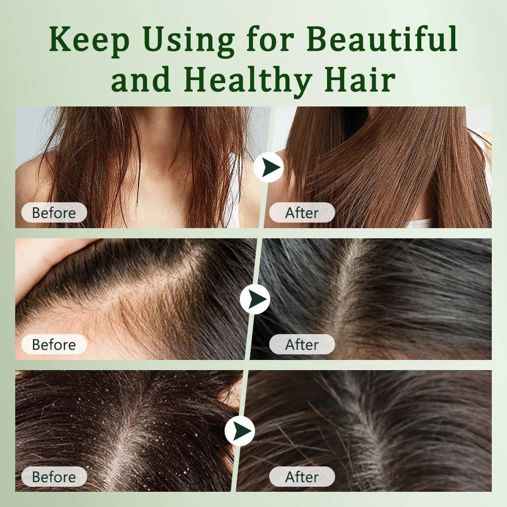 Natural Herbal Shampoo Soap — Deep Cleansing & Healthier-Looking Hair ——Free Shipping